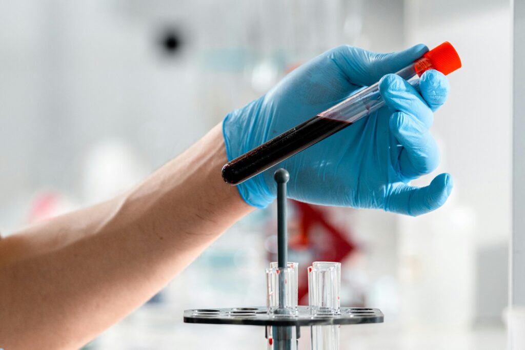 pexels photo 9629693 9629693 Close-up of a gloved hand holding a test tube with blood sample in a clinical research lab.